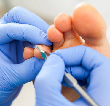 Подологія - красиві та здорові нігті